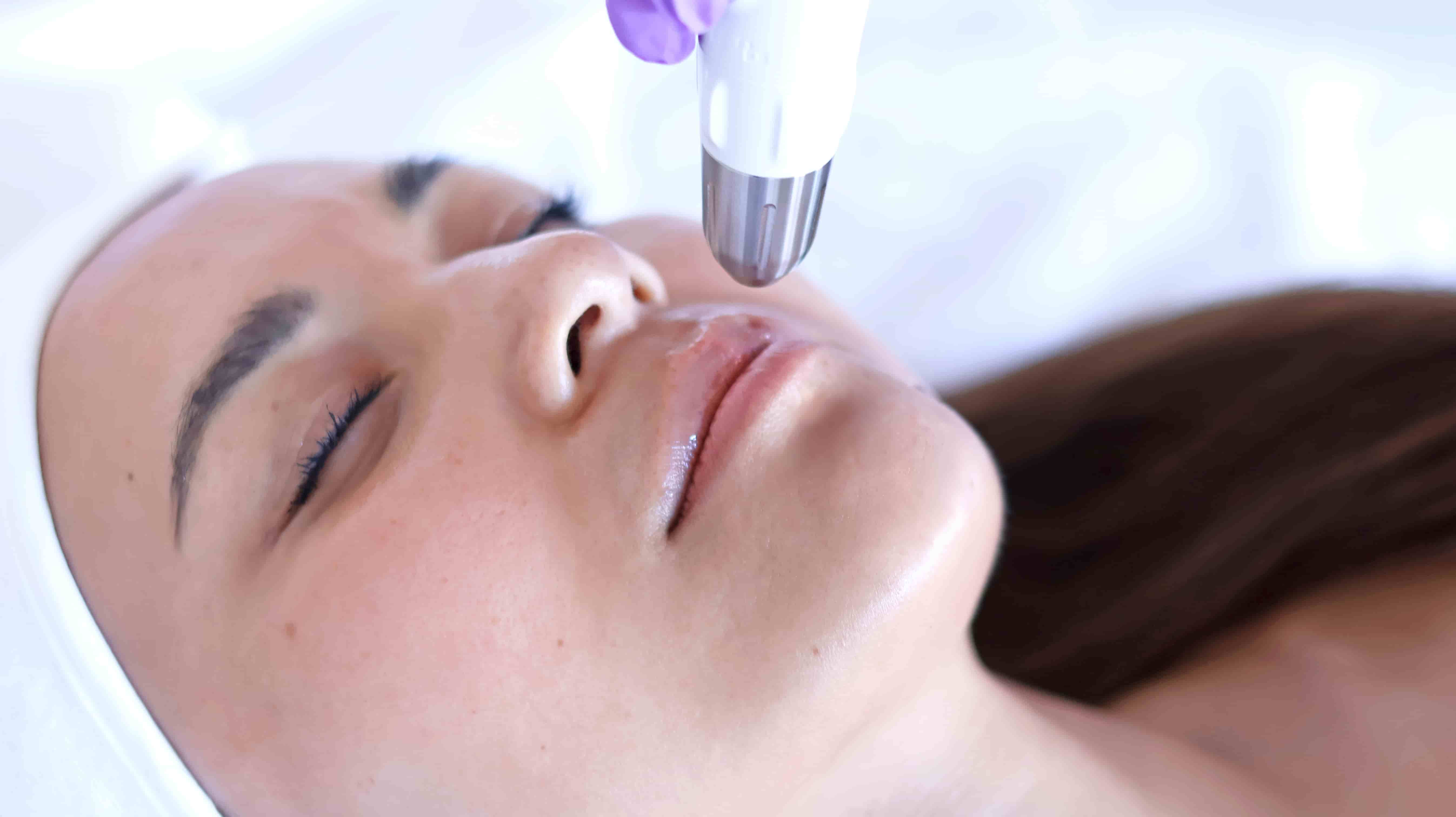 Professionelle Gesichtsbehandlung mit Dermadrop